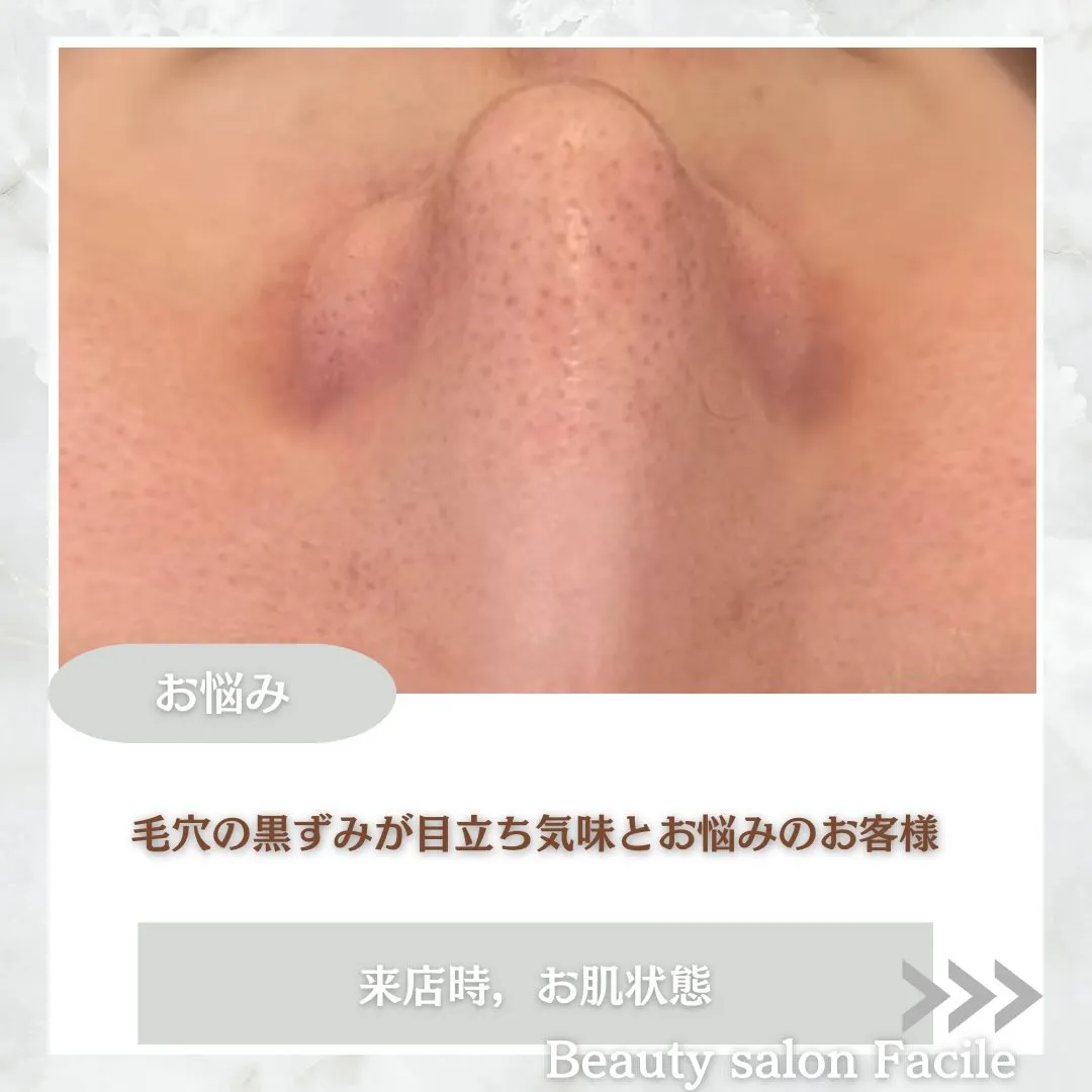 @beautysalonfacile 👈🏻他投稿もチェック