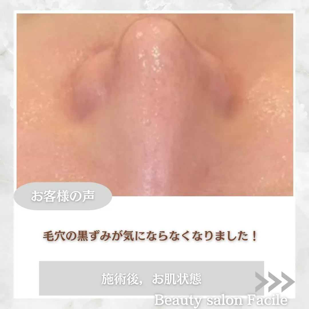 @beautysalonfacile 👈🏻他投稿もチェック
