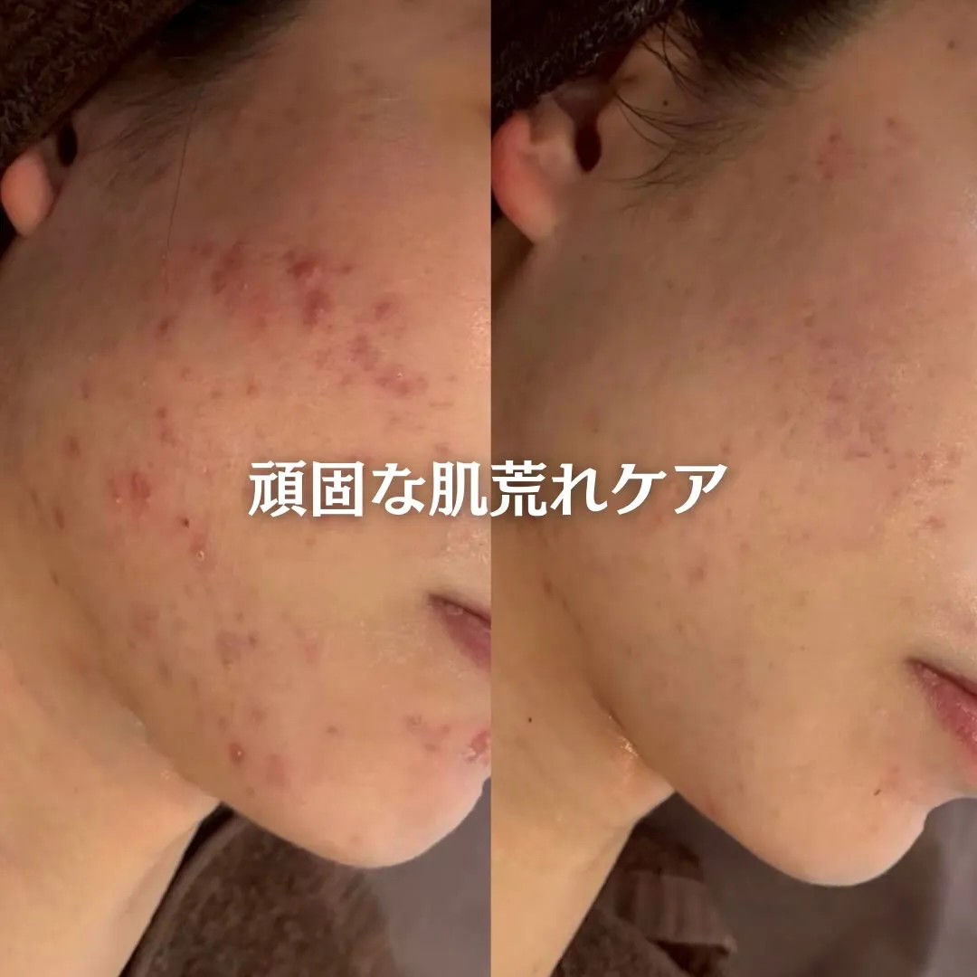 @beautysalonfacile 👈🏻他投稿もチェック