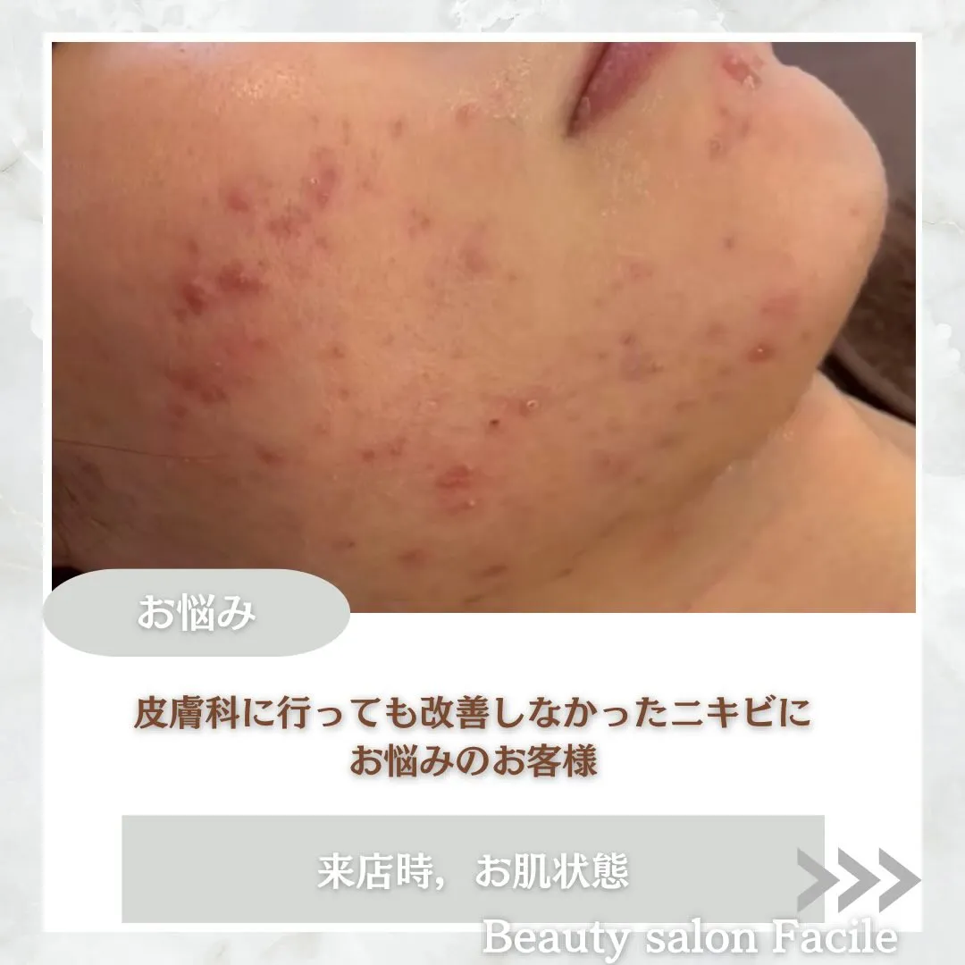 @beautysalonfacile 👈🏻他投稿もチェック