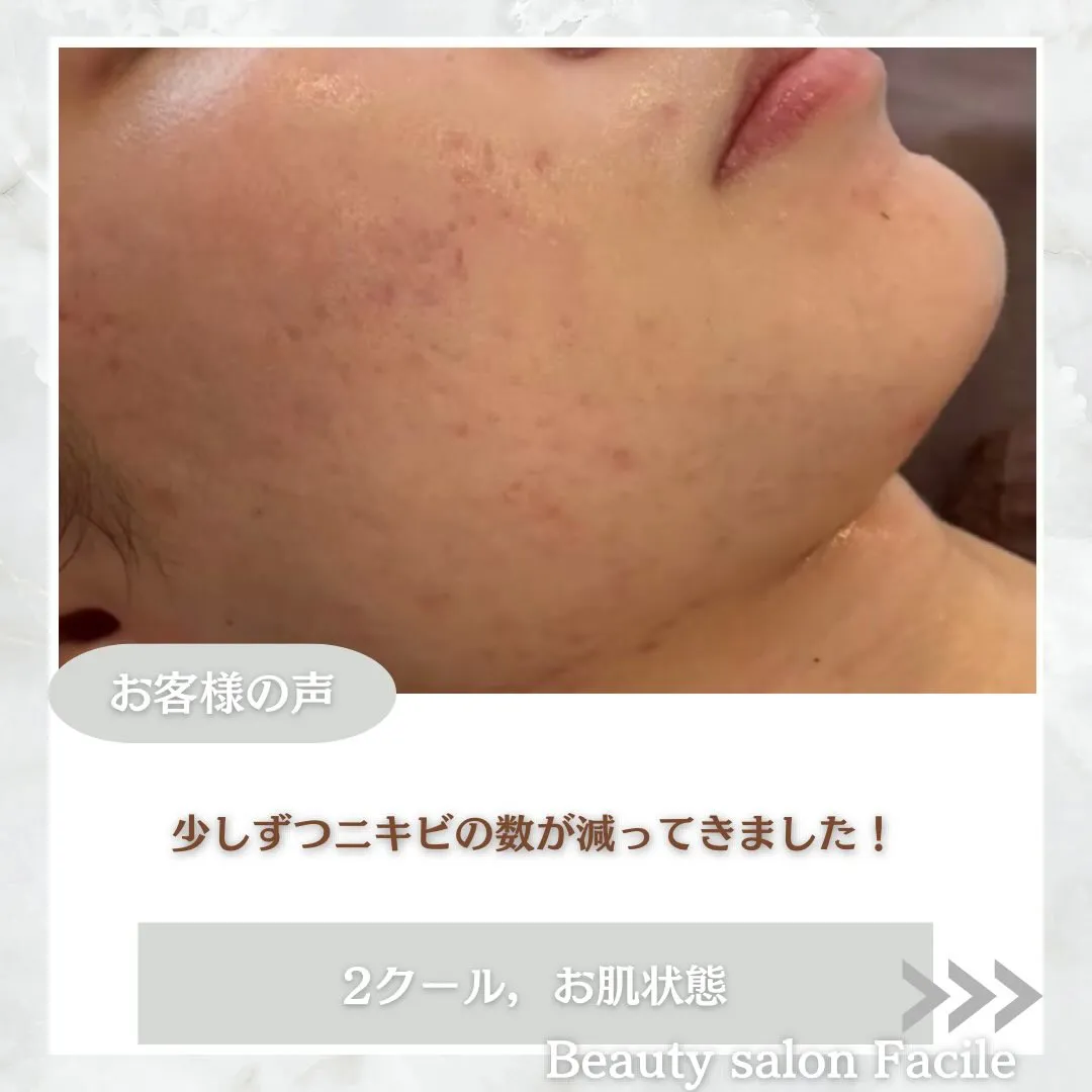 @beautysalonfacile 👈🏻他投稿もチェック