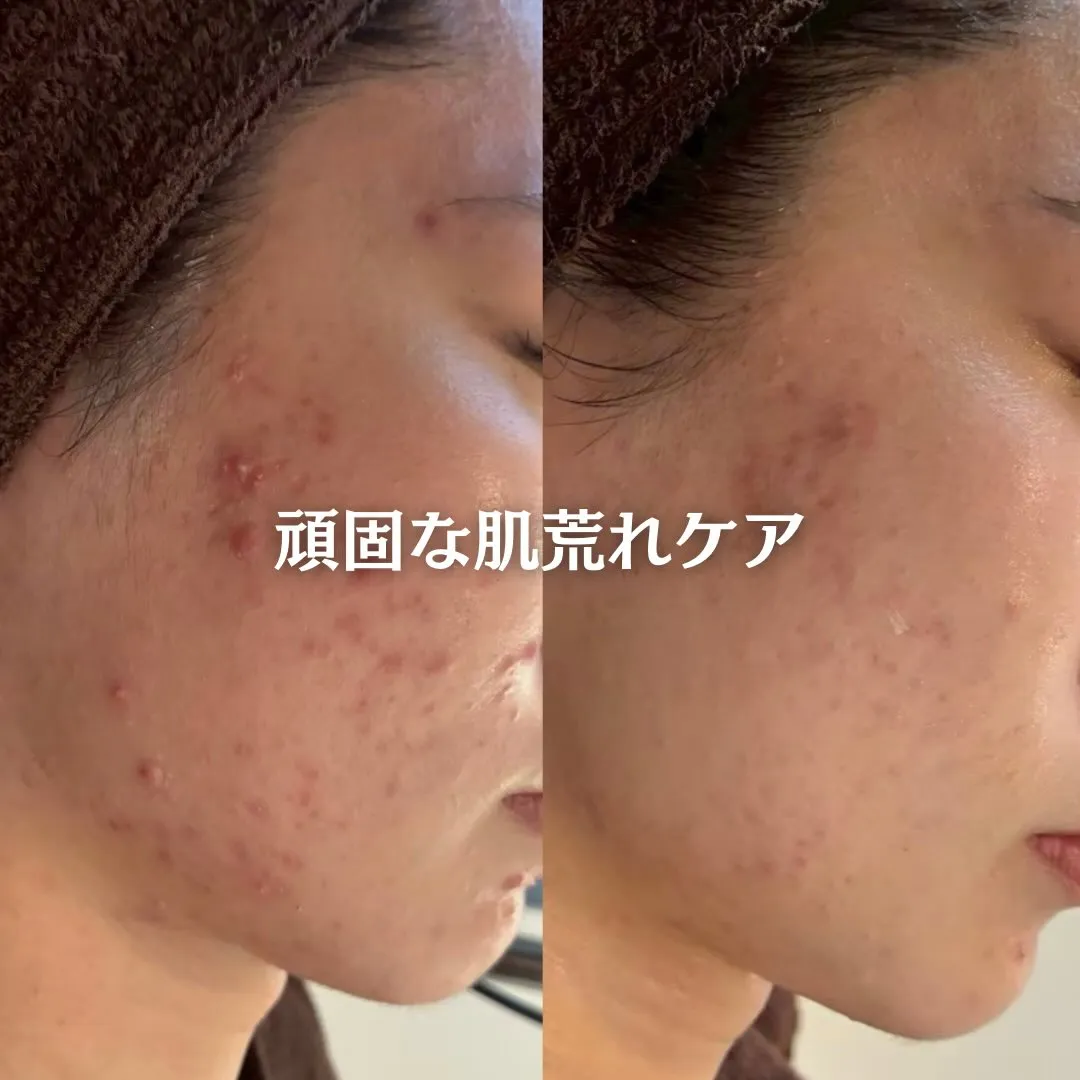 @beautysalonfacile 👈🏻他投稿もチェック