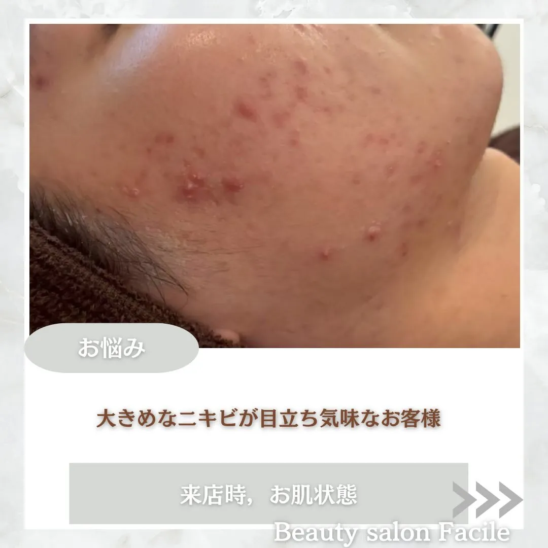 @beautysalonfacile 👈🏻他投稿もチェック