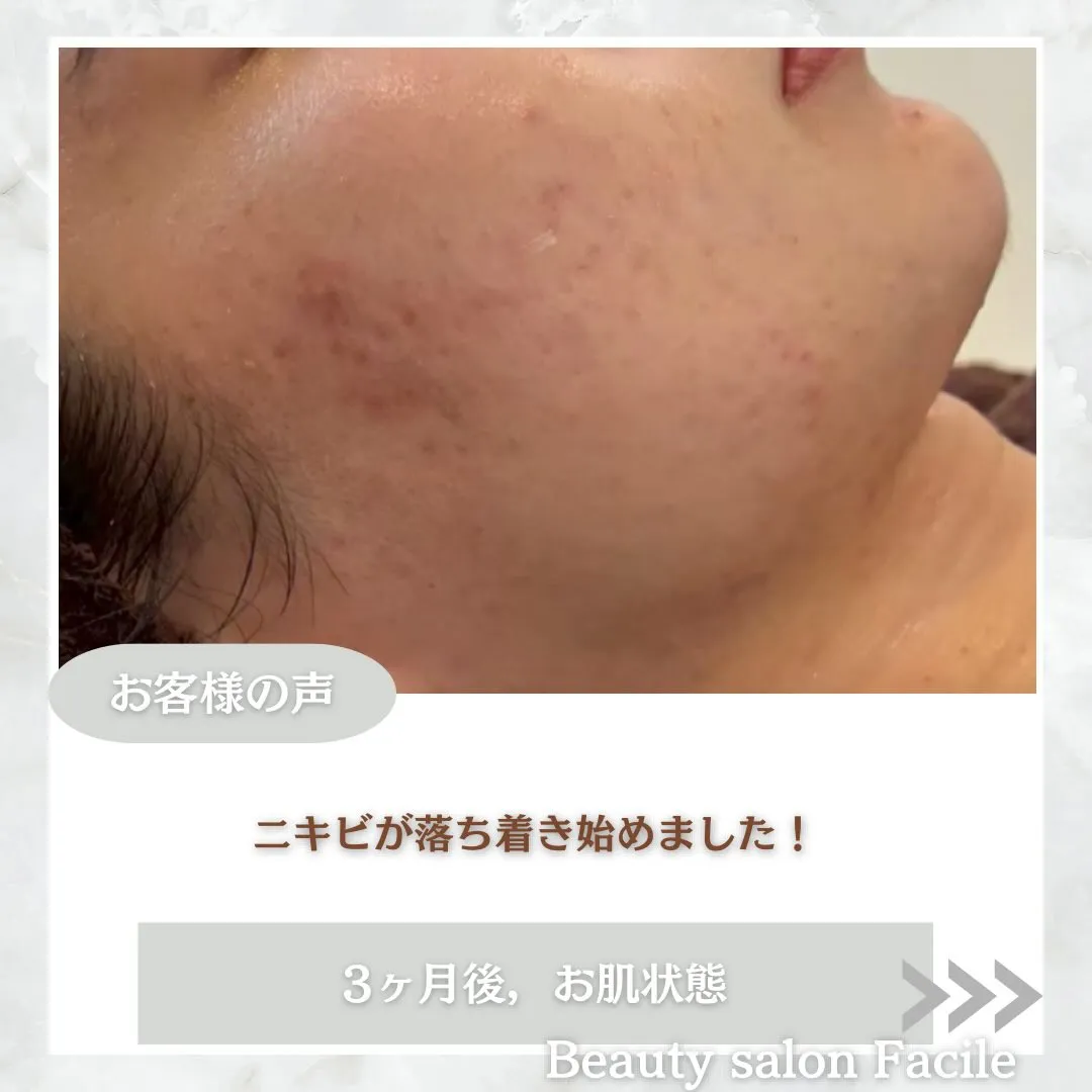 @beautysalonfacile 👈🏻他投稿もチェック