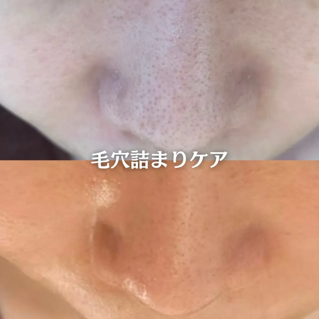 @beautysalonfacile 👈🏻他投稿もチェック