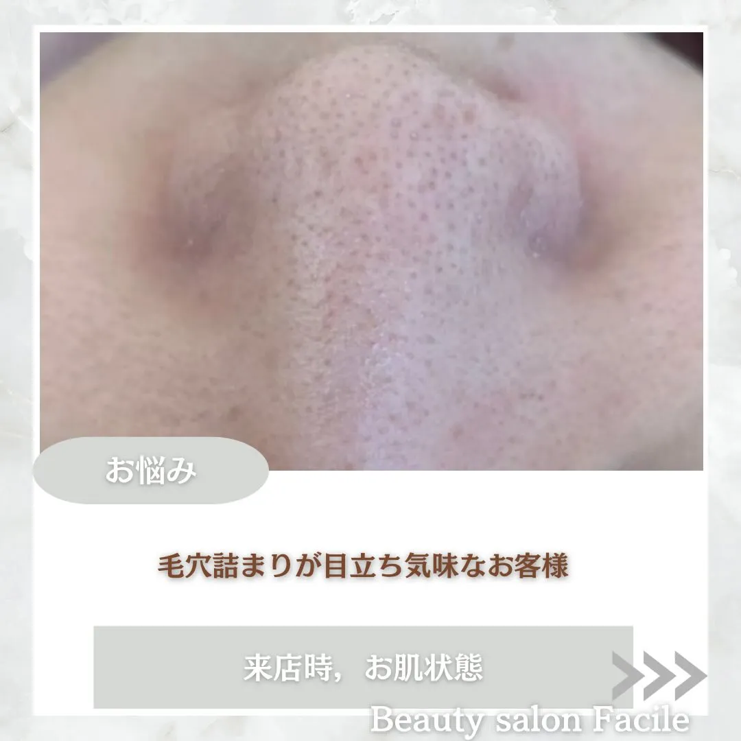 @beautysalonfacile 👈🏻他投稿もチェック