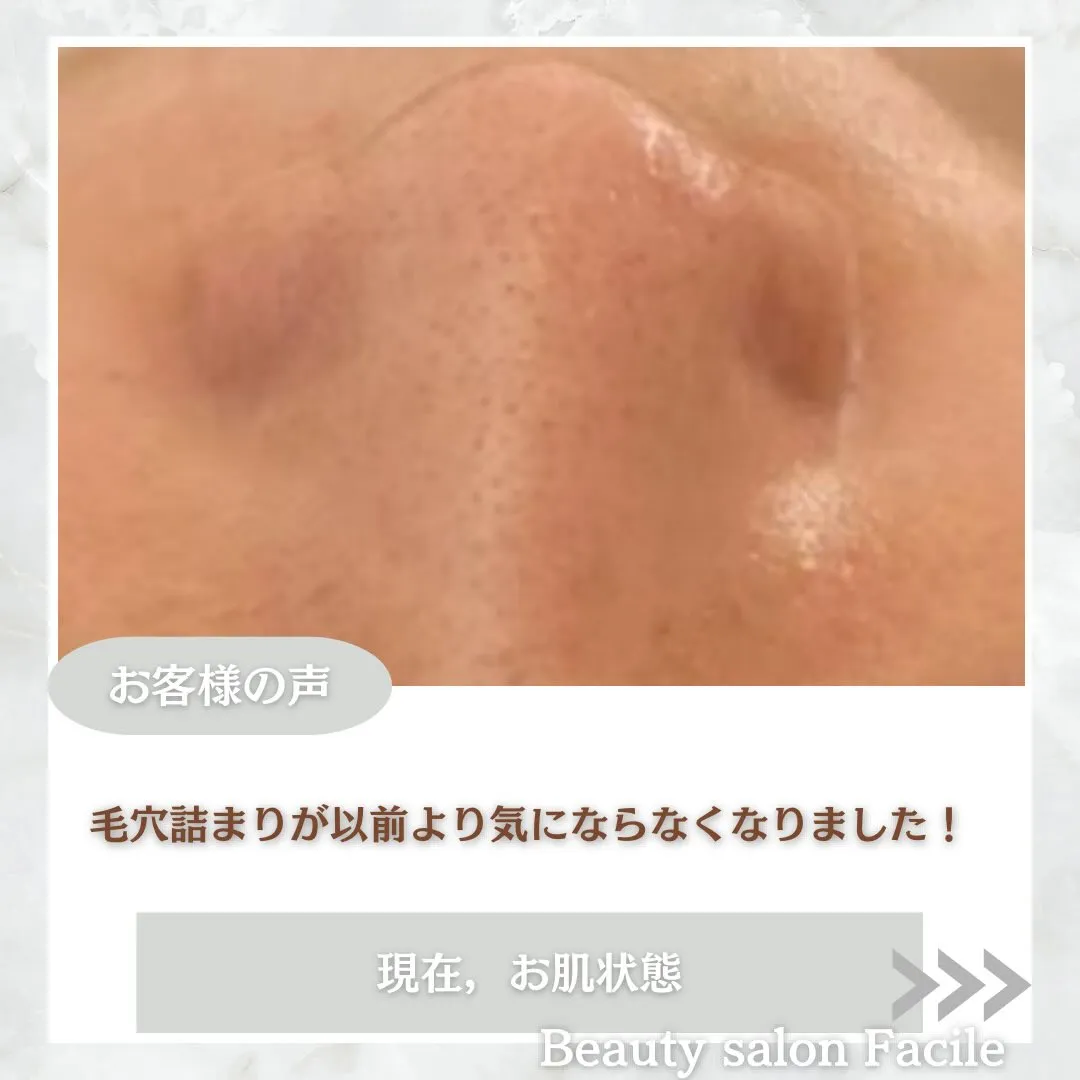 @beautysalonfacile 👈🏻他投稿もチェック
