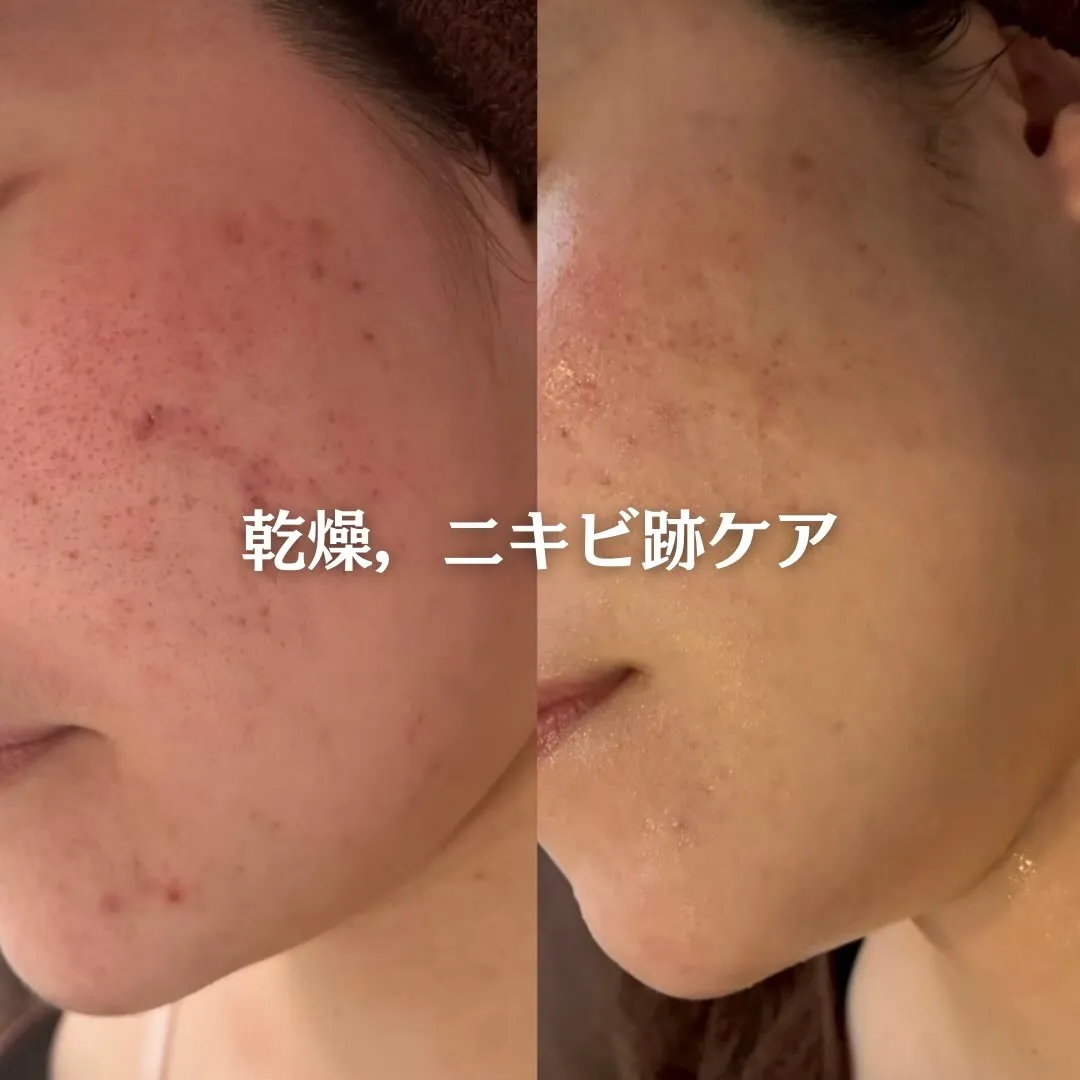 @beautysalonfacile 👈🏻他投稿もチェック
