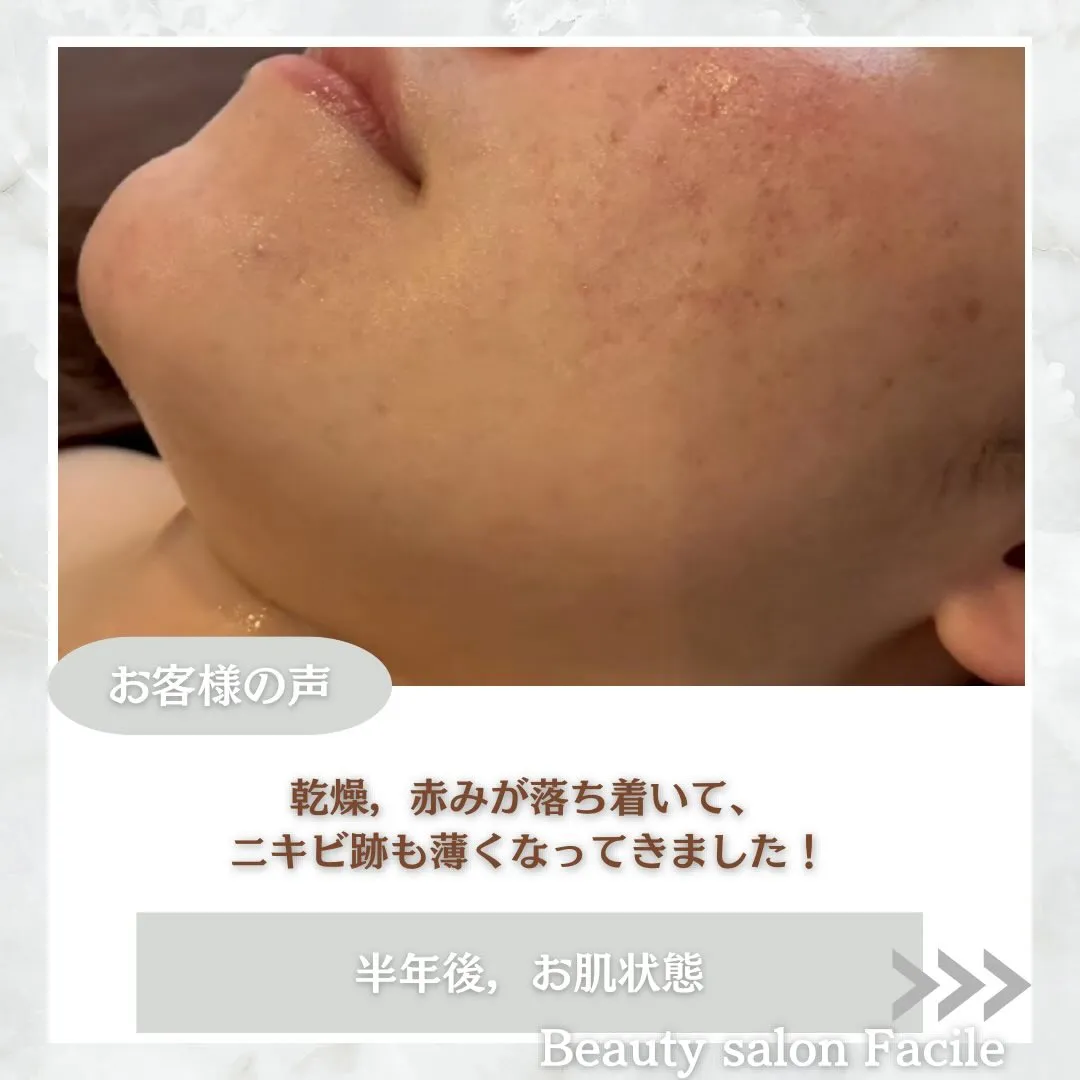 @beautysalonfacile 👈🏻他投稿もチェック