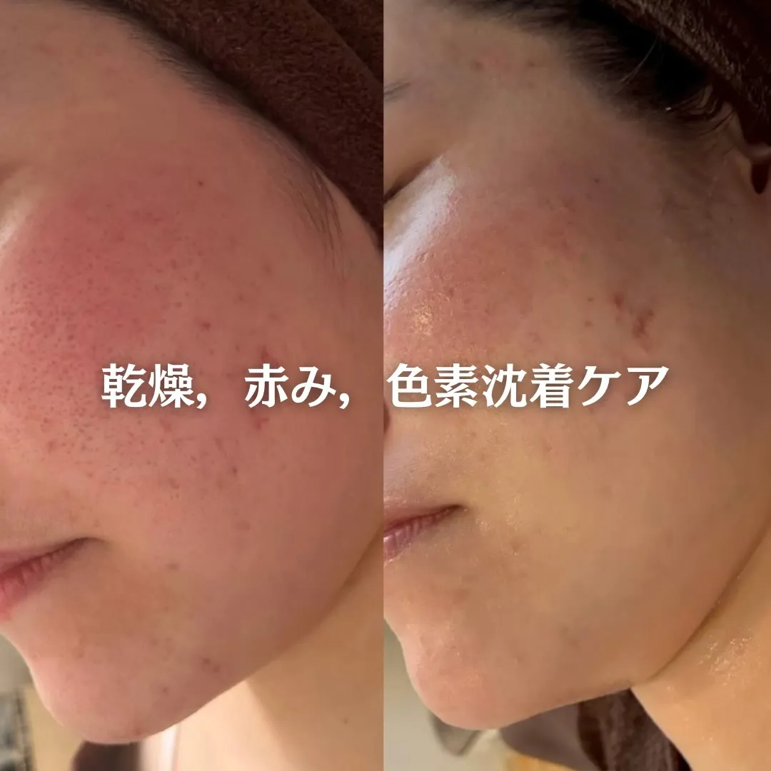 @beautysalonfacile 👈🏻他投稿もチェック