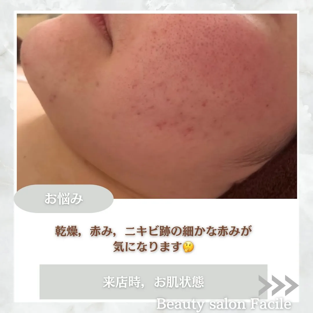 @beautysalonfacile 👈🏻他投稿もチェック