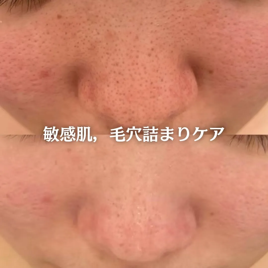@beautysalonfacile 👈🏻他投稿もチェック