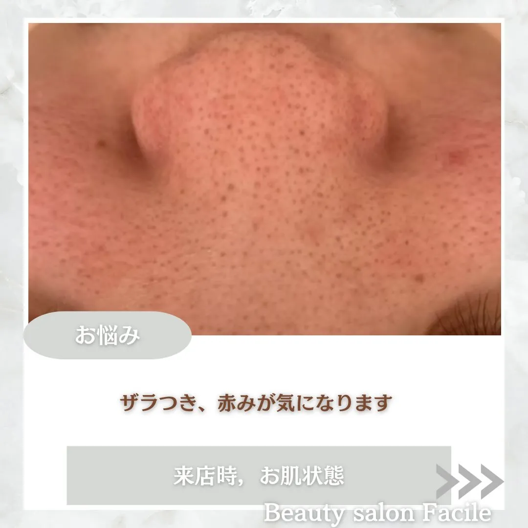 @beautysalonfacile 👈🏻他投稿もチェック