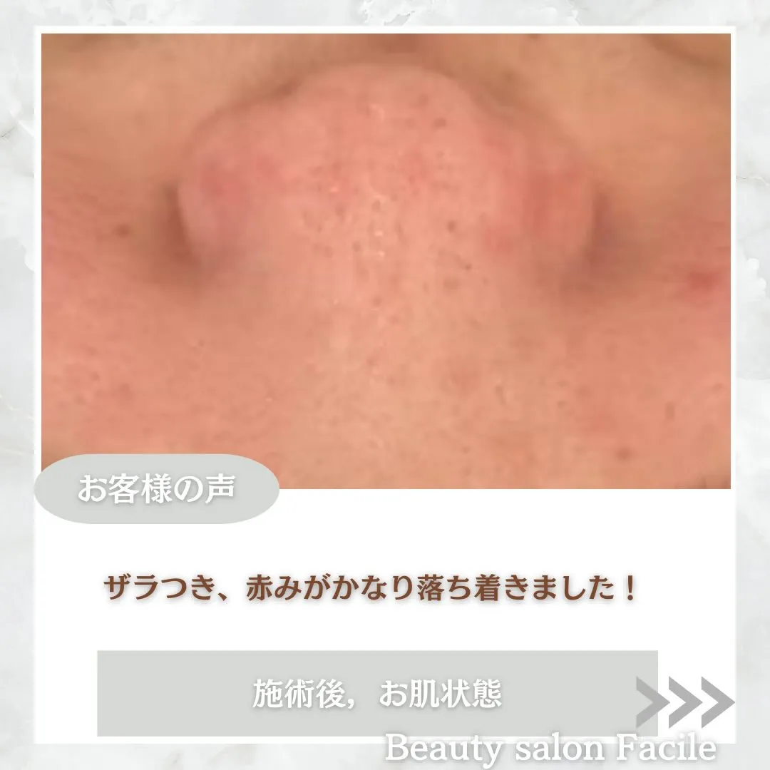 @beautysalonfacile 👈🏻他投稿もチェック