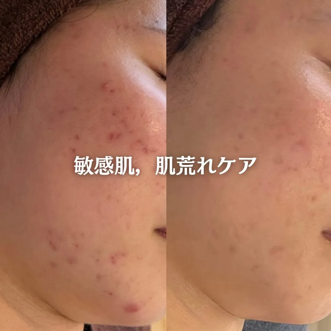 @beautysalonfacile 👈🏻他投稿もチェック
