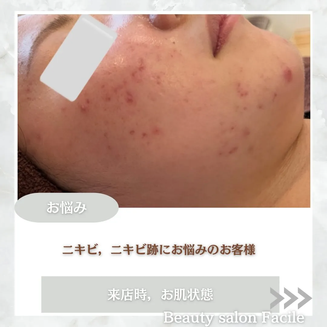 @beautysalonfacile 👈🏻他投稿もチェック
