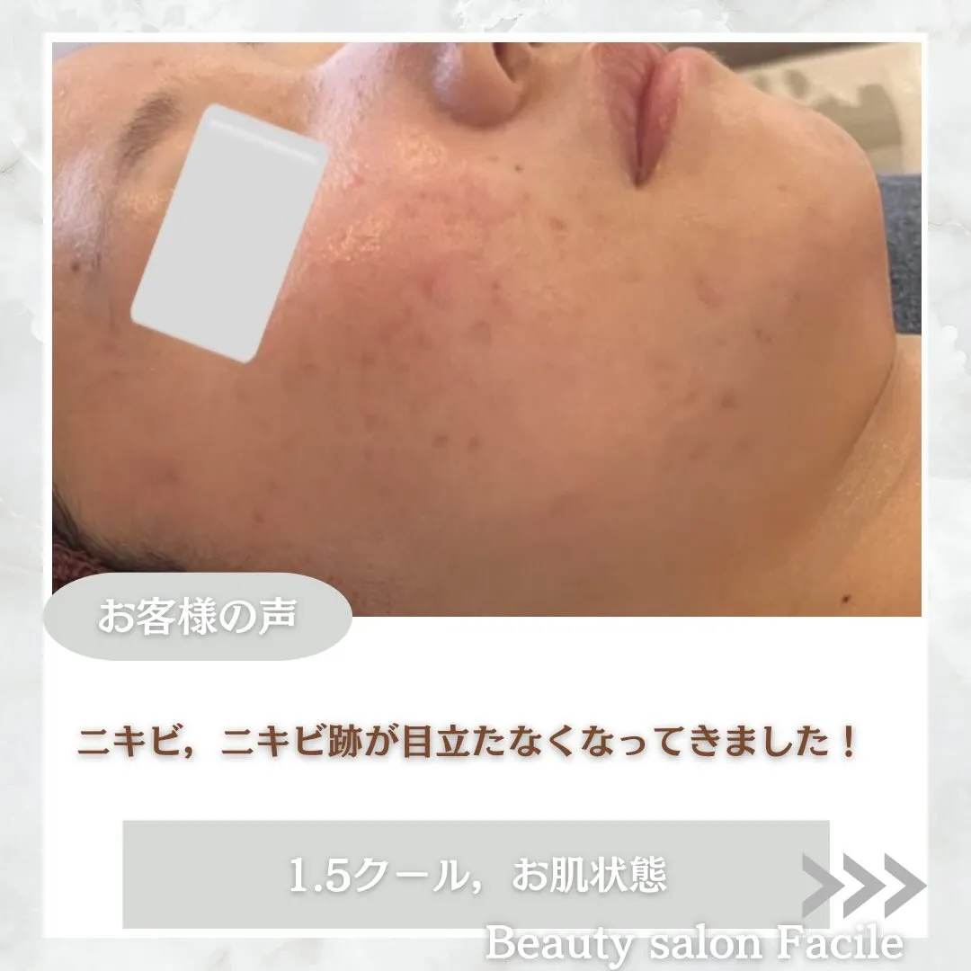 @beautysalonfacile 👈🏻他投稿もチェック