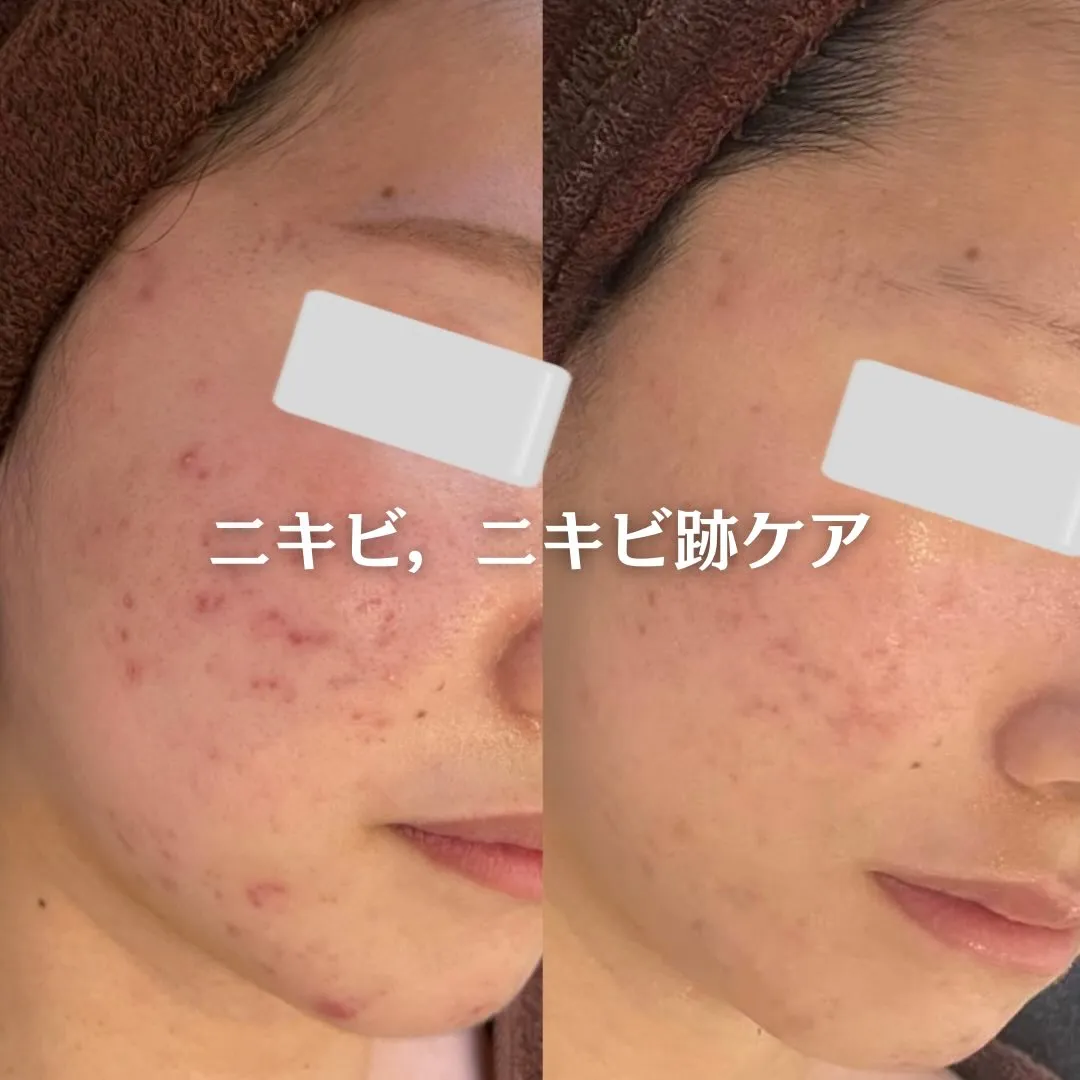 @beautysalonfacile 👈🏻他投稿もチェック