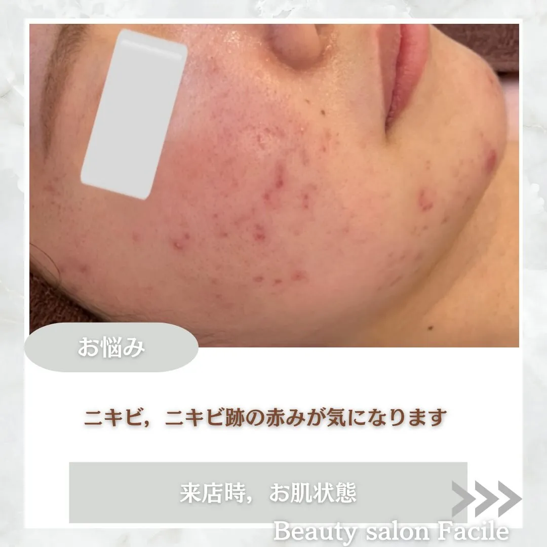@beautysalonfacile 👈🏻他投稿もチェック