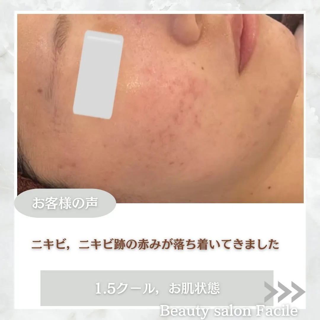 @beautysalonfacile 👈🏻他投稿もチェック