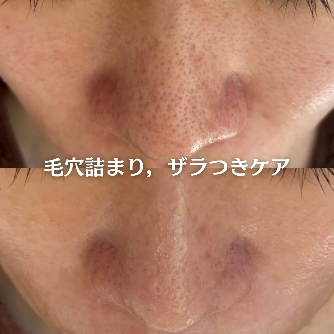 @beautysalonfacile 👈🏻他投稿もチェック