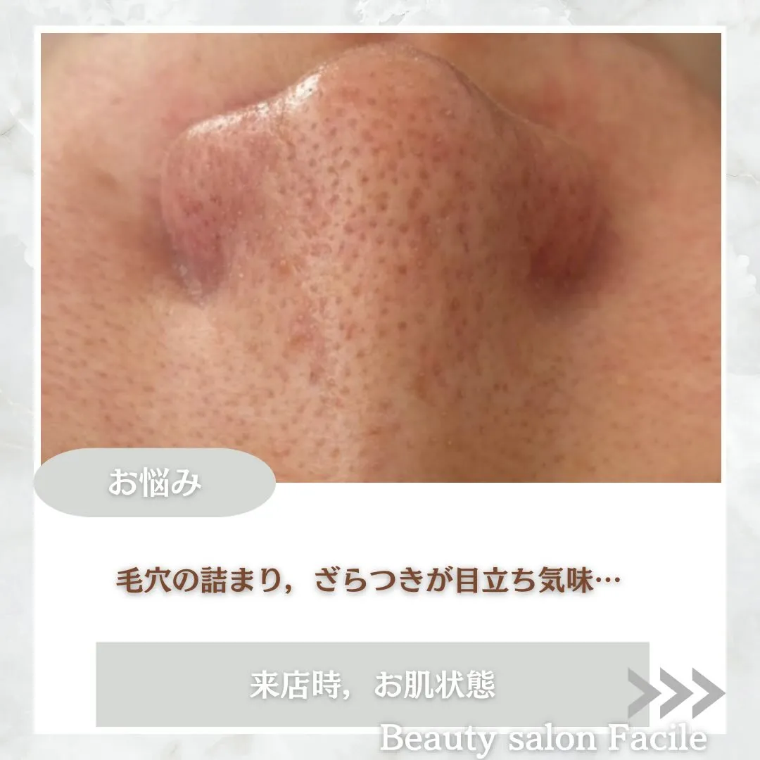@beautysalonfacile 👈🏻他投稿もチェック