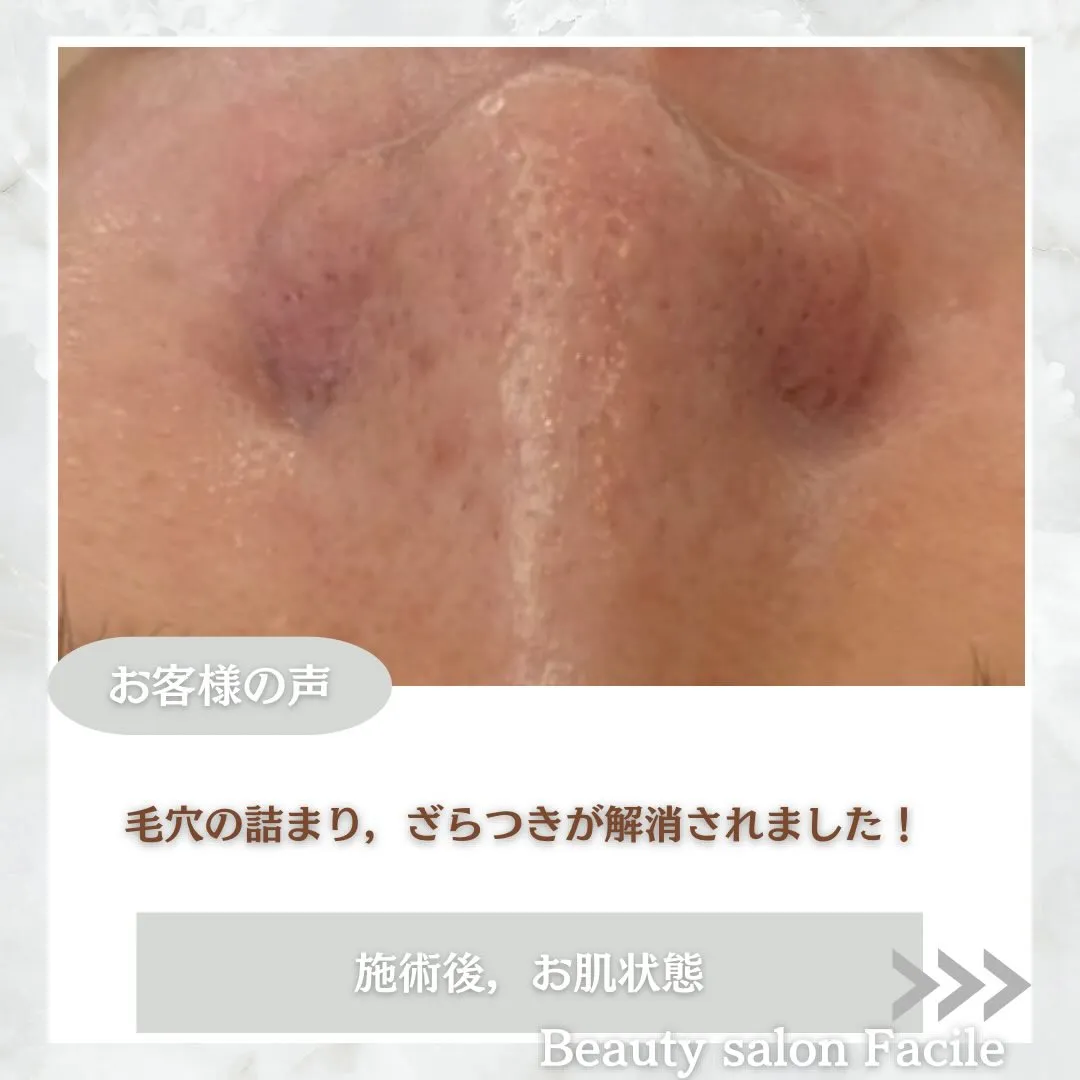 @beautysalonfacile 👈🏻他投稿もチェック