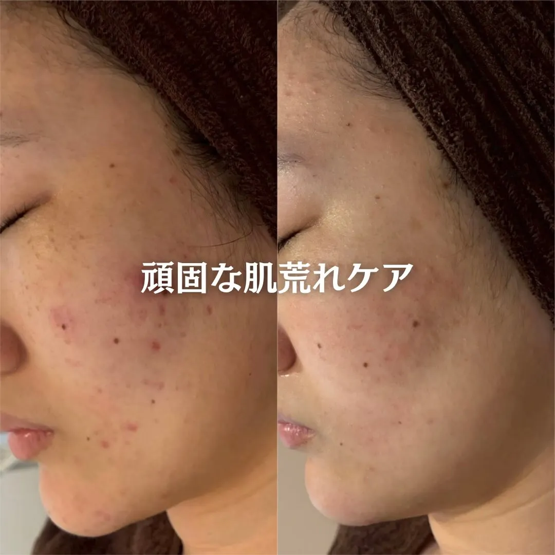 @beautysalonfacile 👈🏻他投稿もチェック