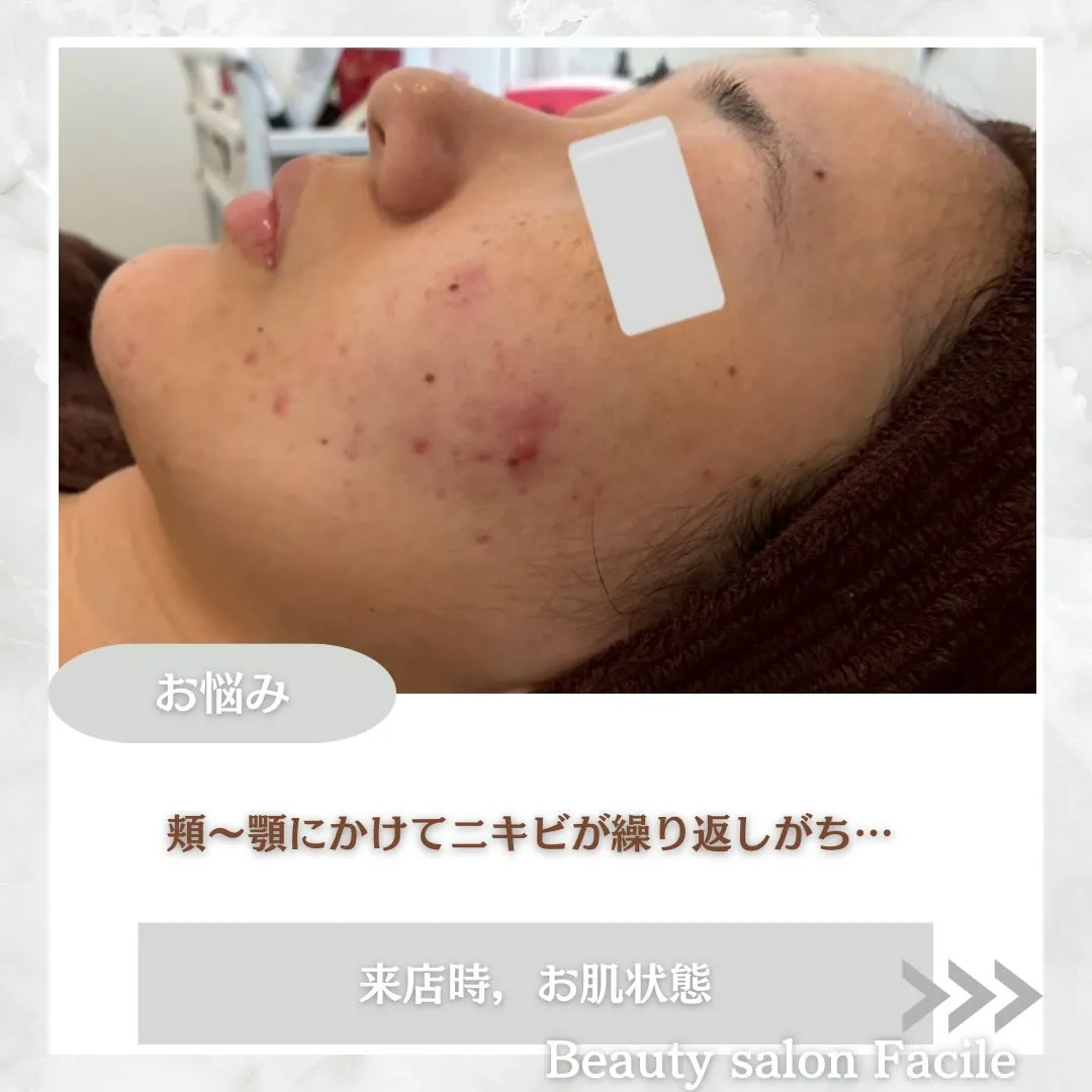 @beautysalonfacile 👈🏻他投稿もチェック