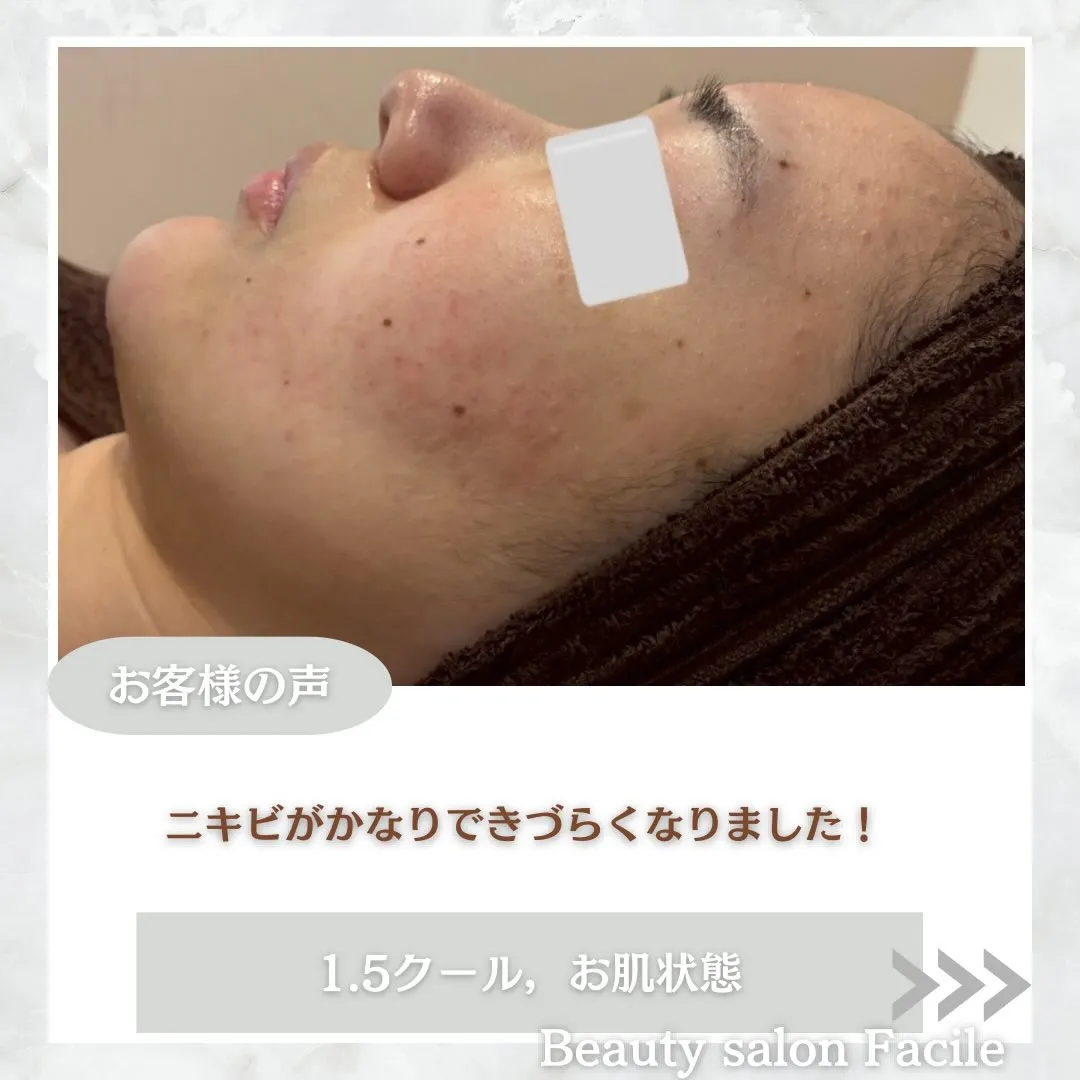@beautysalonfacile 👈🏻他投稿もチェック