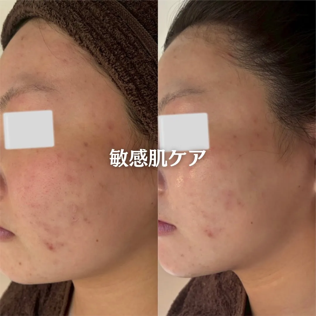 @beautysalonfacile 👈🏻他投稿もチェック