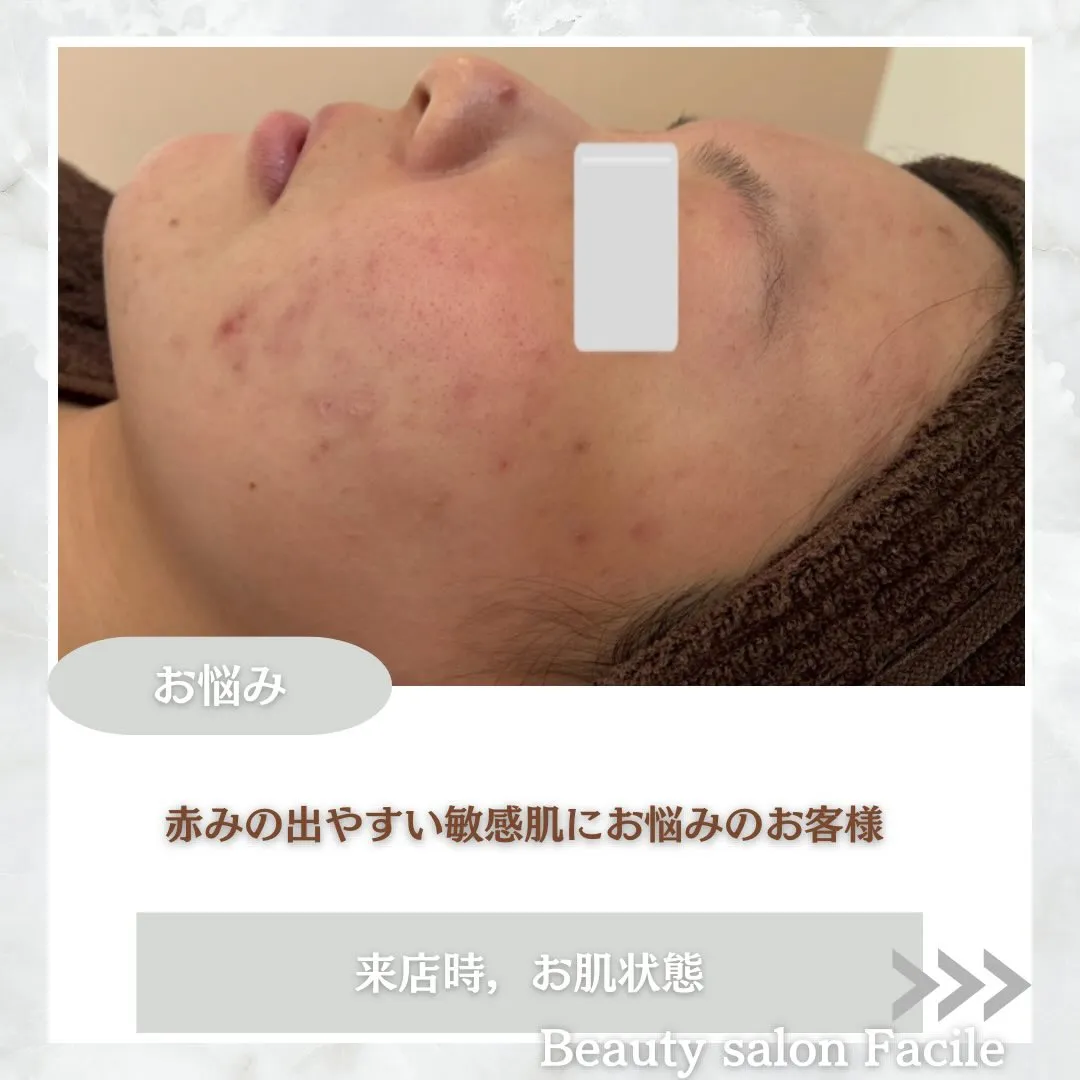 @beautysalonfacile 👈🏻他投稿もチェック