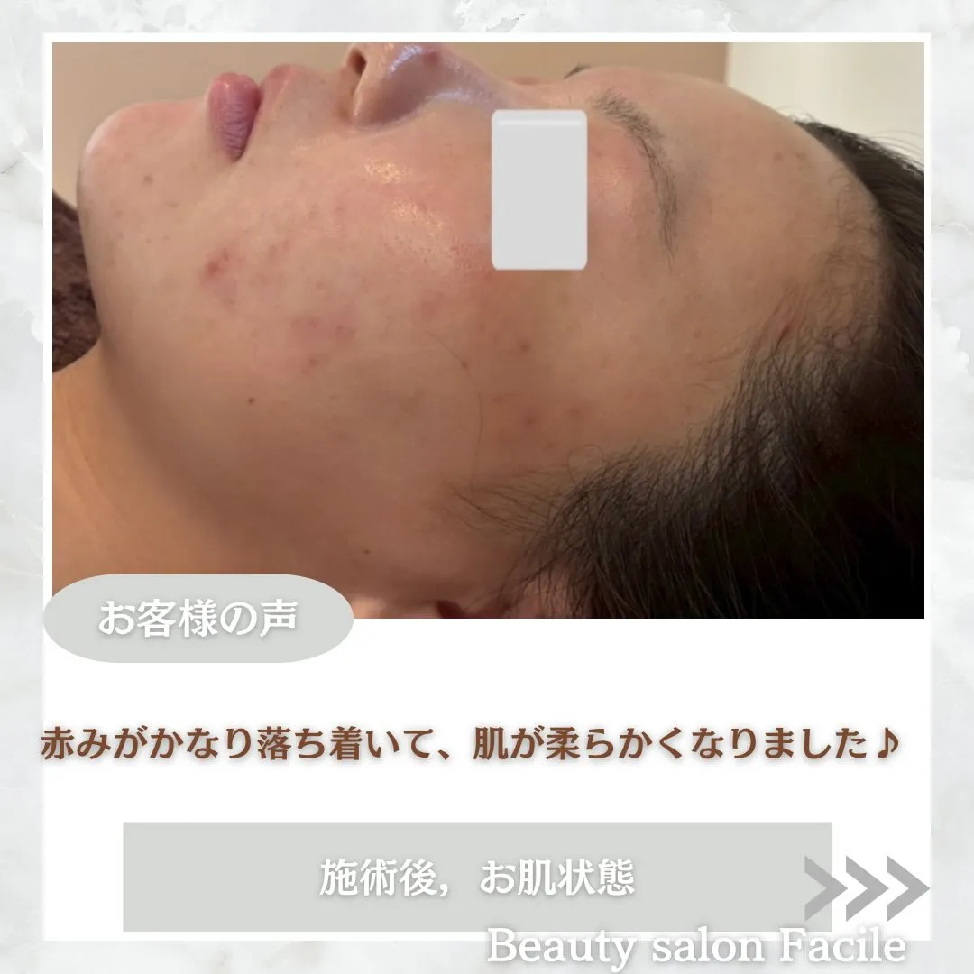 @beautysalonfacile 👈🏻他投稿もチェック