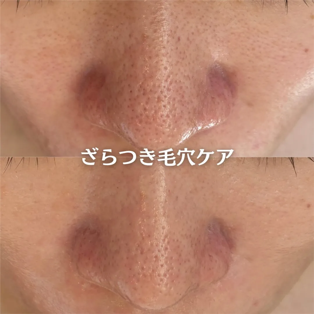@beautysalonfacile 👈🏻他投稿もチェック