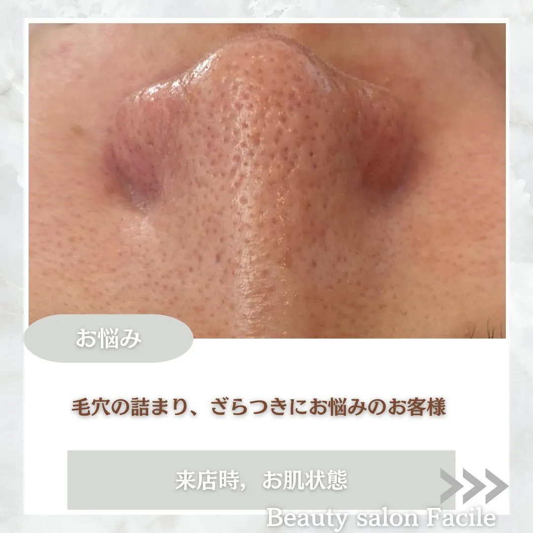 @beautysalonfacile 👈🏻他投稿もチェック