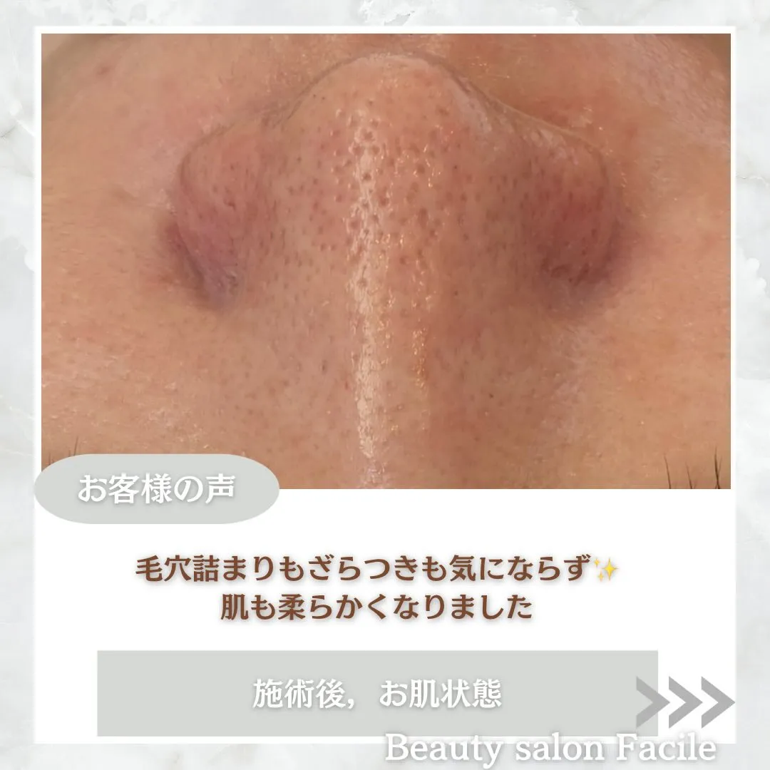 @beautysalonfacile 👈🏻他投稿もチェック