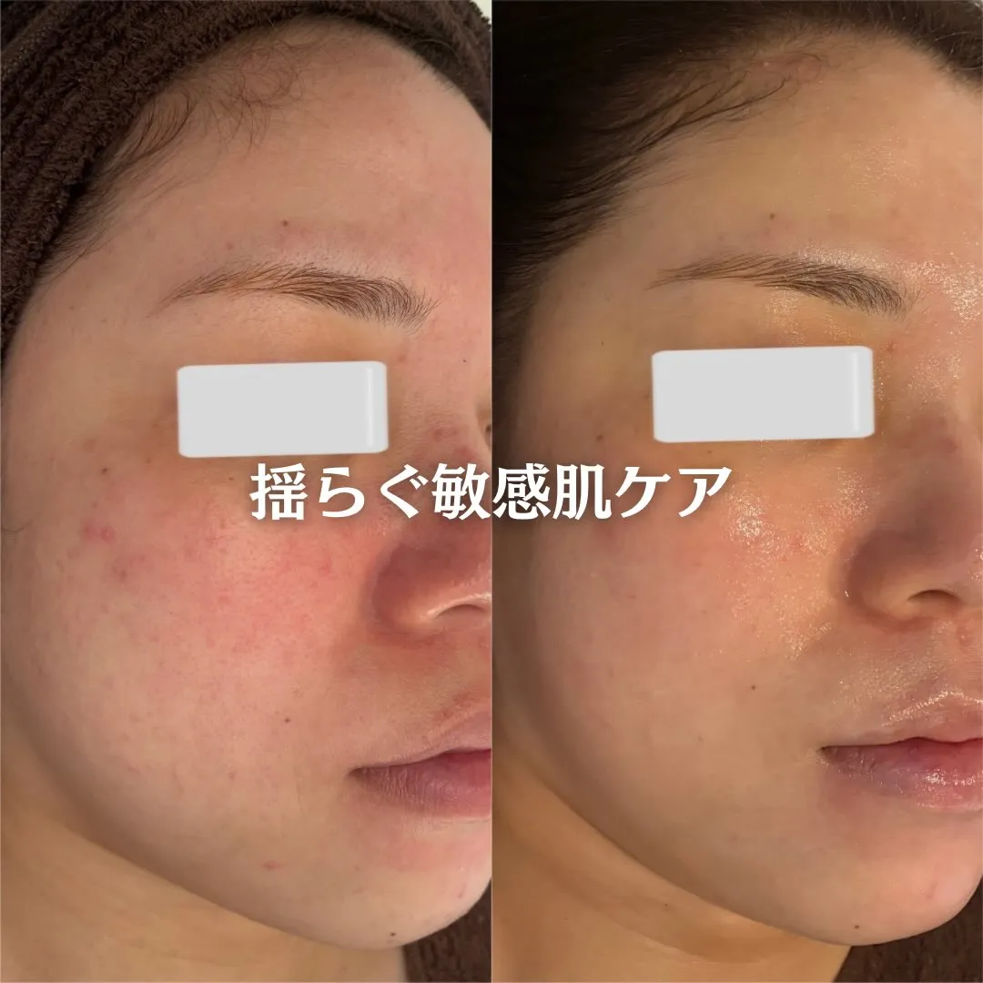 @beautysalonfacile 👈🏻他投稿もチェック