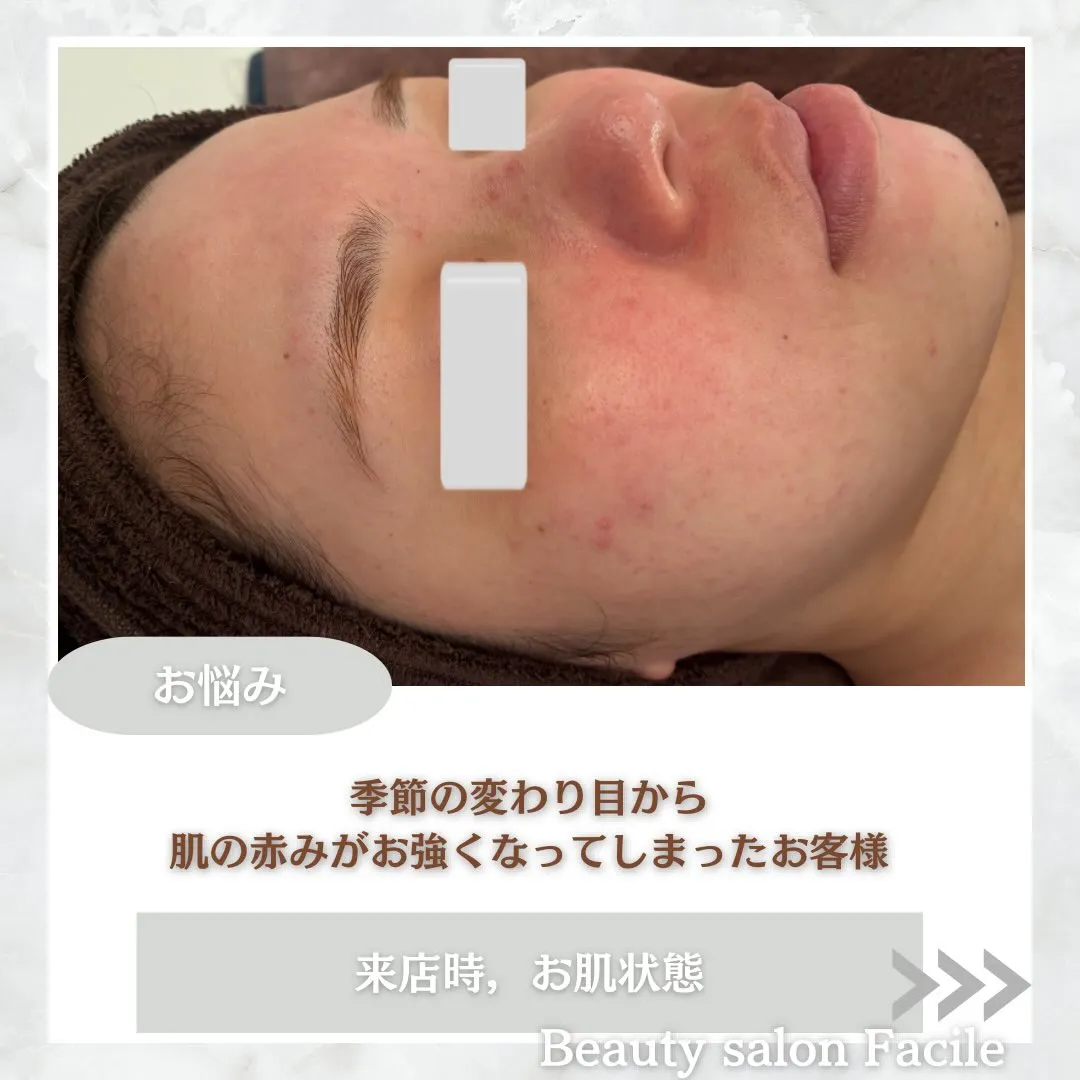 @beautysalonfacile 👈🏻他投稿もチェック