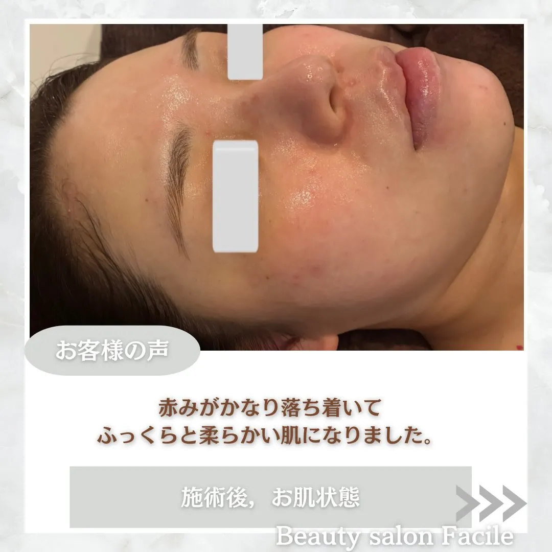 @beautysalonfacile 👈🏻他投稿もチェック