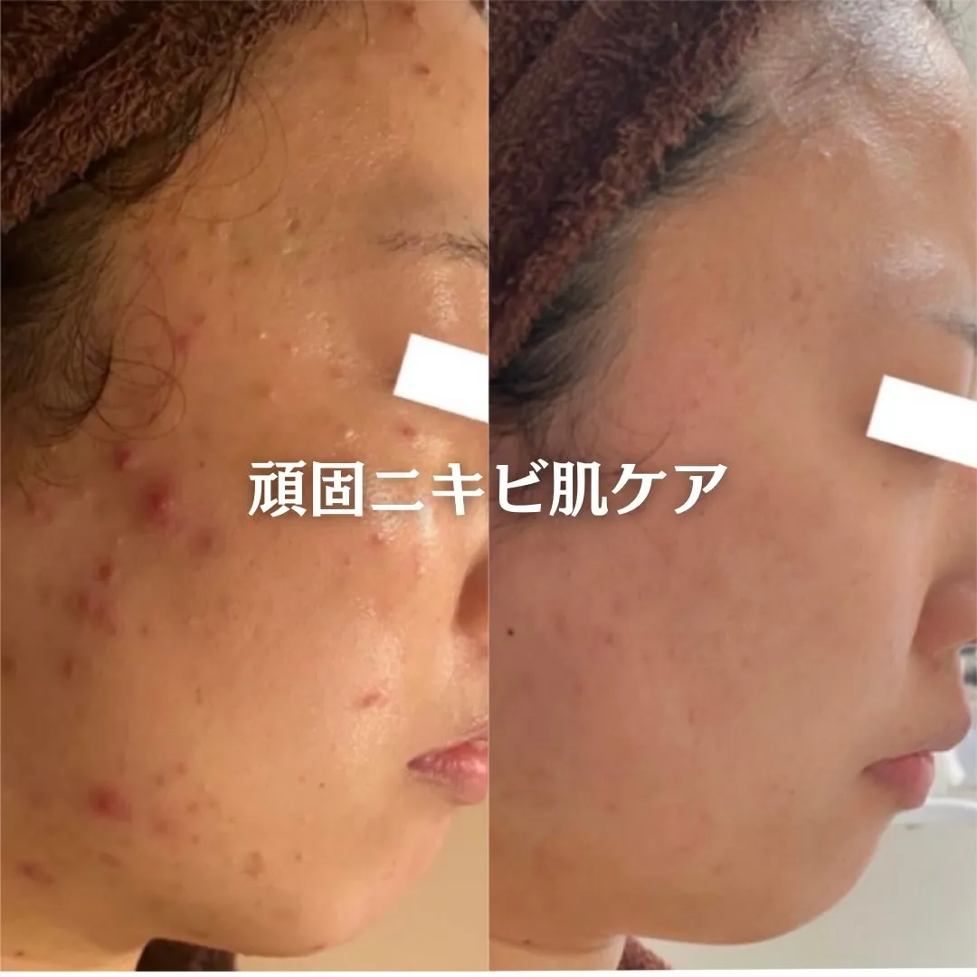 @beautysalonfacile 👈🏻他投稿もチェック