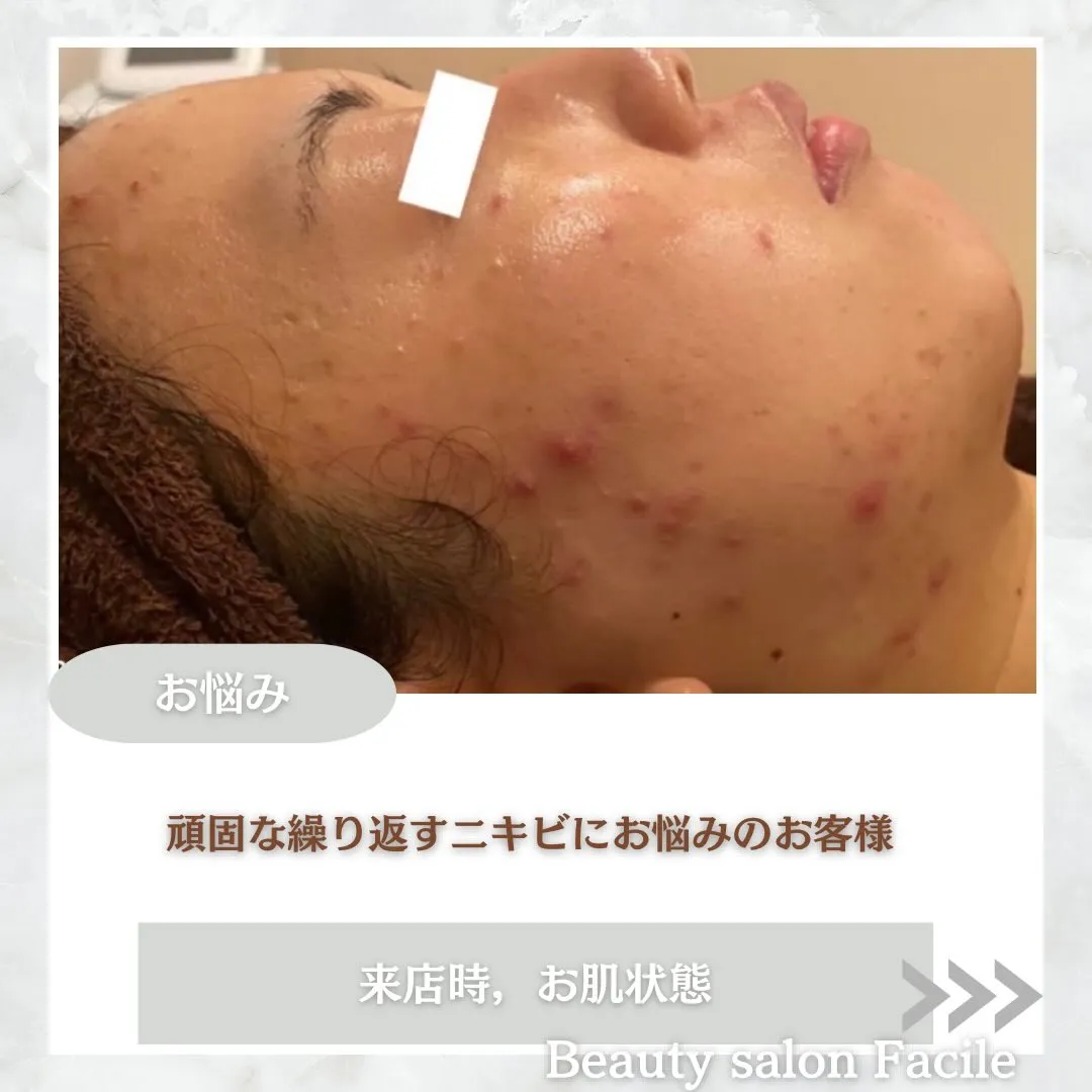 @beautysalonfacile 👈🏻他投稿もチェック