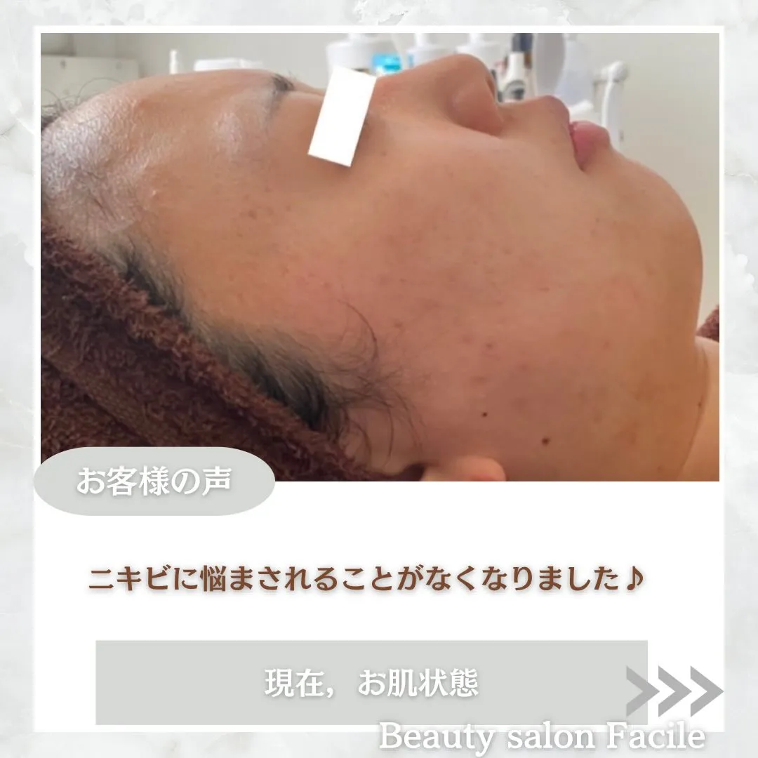 @beautysalonfacile 👈🏻他投稿もチェック