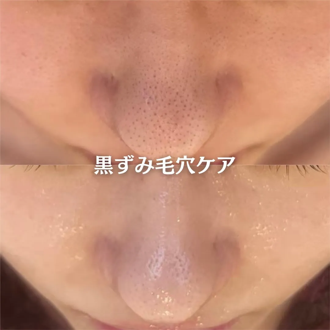 @beautysalonfacile 👈🏻他投稿もチェック