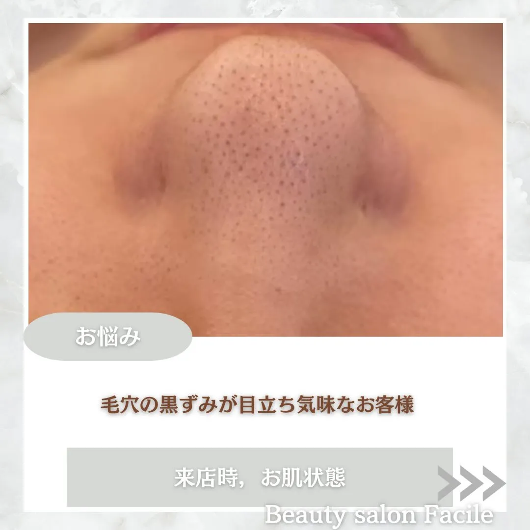 @beautysalonfacile 👈🏻他投稿もチェック