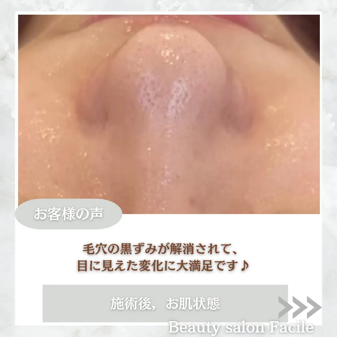 @beautysalonfacile 👈🏻他投稿もチェック