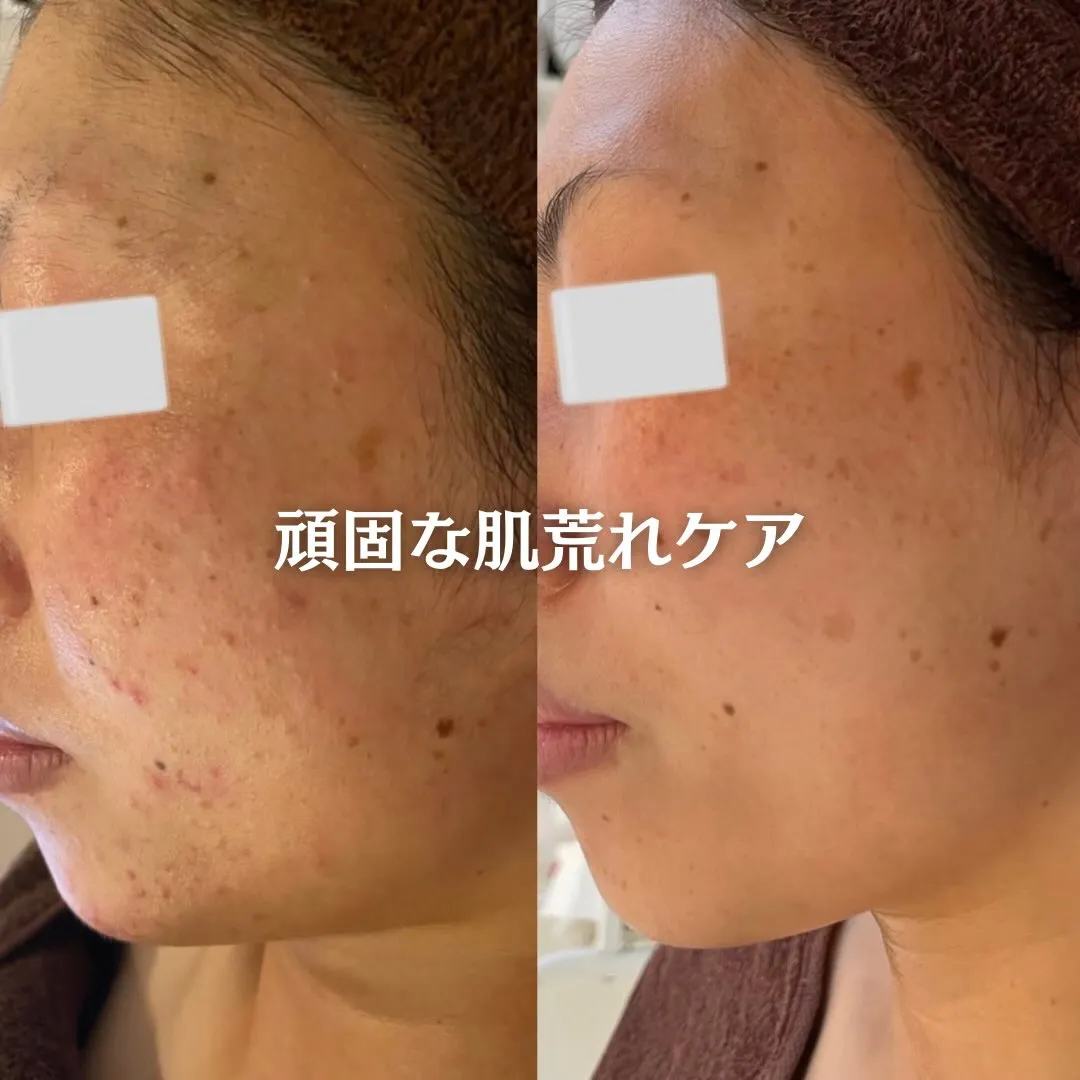 @beautysalonfacile 👈🏻他投稿もチェック