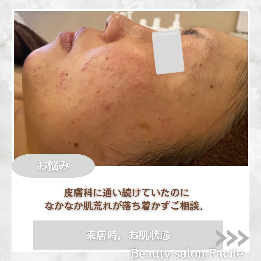 @beautysalonfacile 👈🏻他投稿もチェック