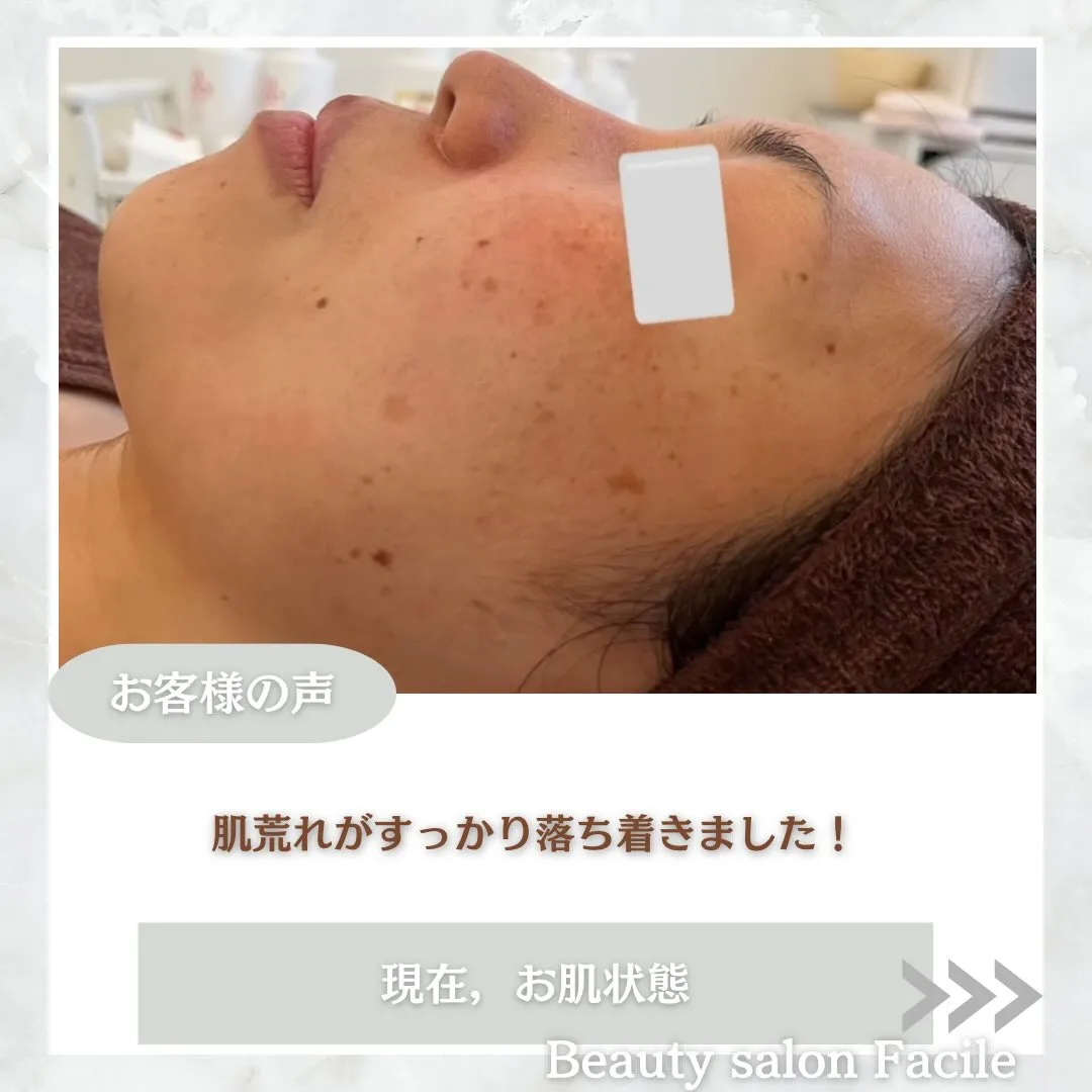 @beautysalonfacile 👈🏻他投稿もチェック