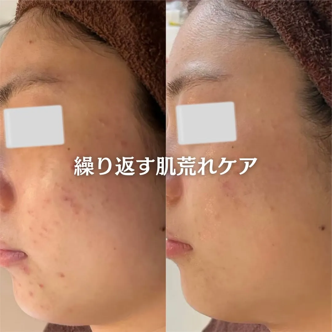 @beautysalonfacile 👈🏻他投稿もチェック
