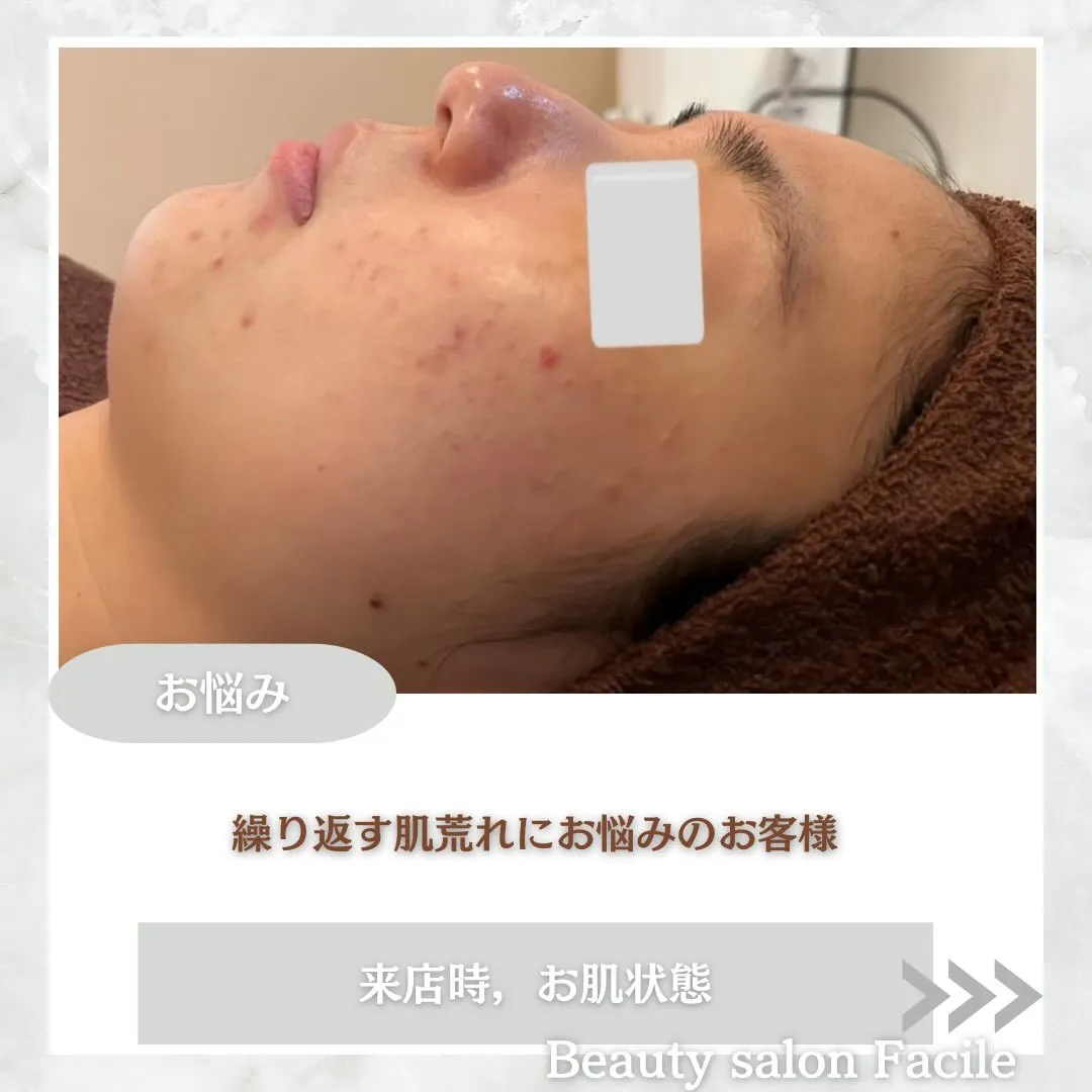 @beautysalonfacile 👈🏻他投稿もチェック